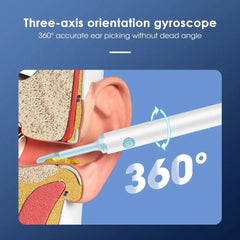 Wireless Smart Visual Ear Cleaner